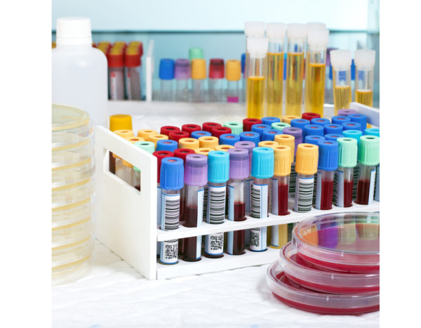 Vials and testtubes