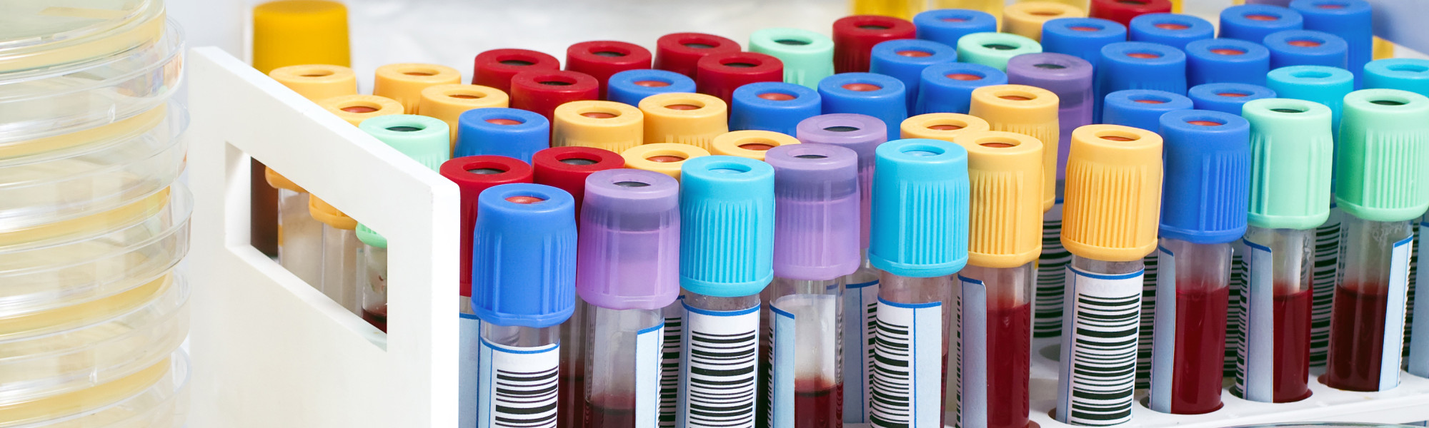 Vials and test tubes