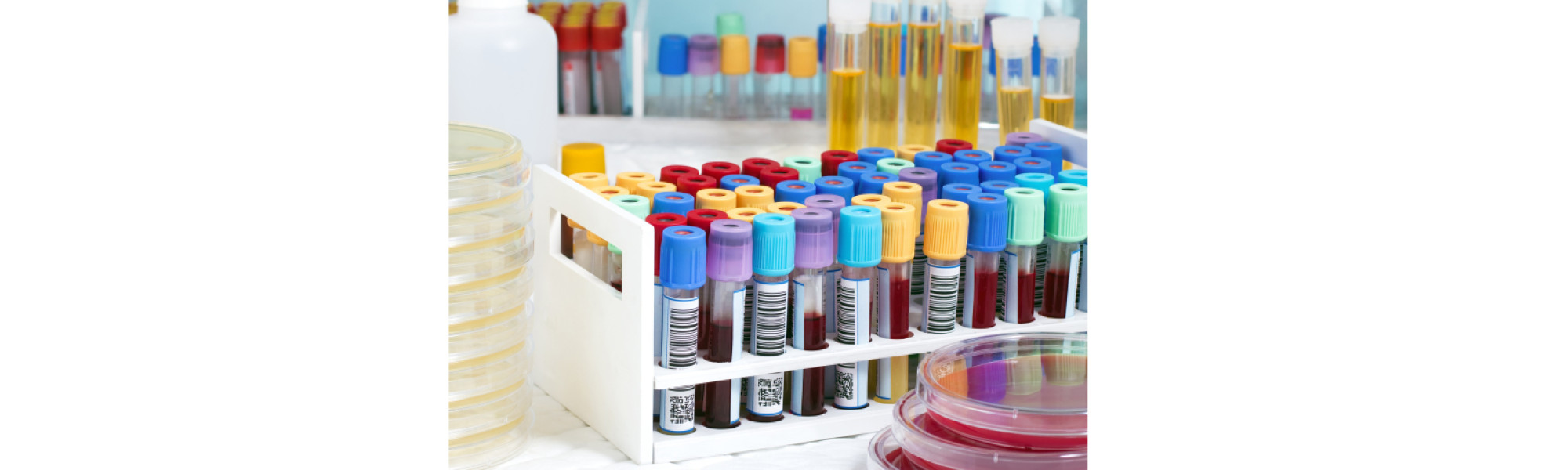 Vials and testtubes